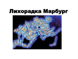 Лихорадка Марбург