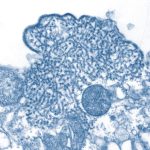 Информация о вспышке в Индии заболевания, вызванного вирусом Нипах